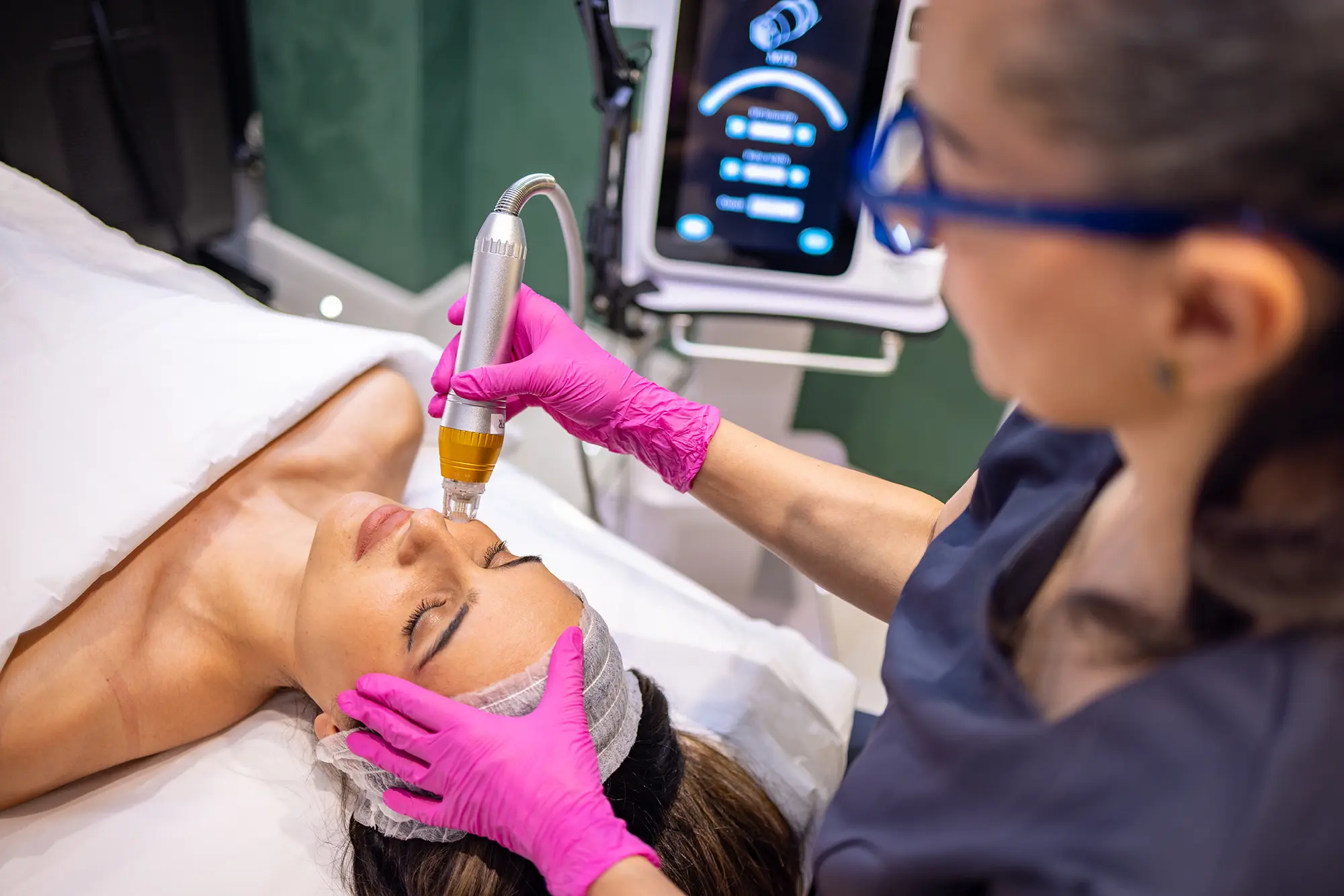 Beautie Lab Microneedling Eltham