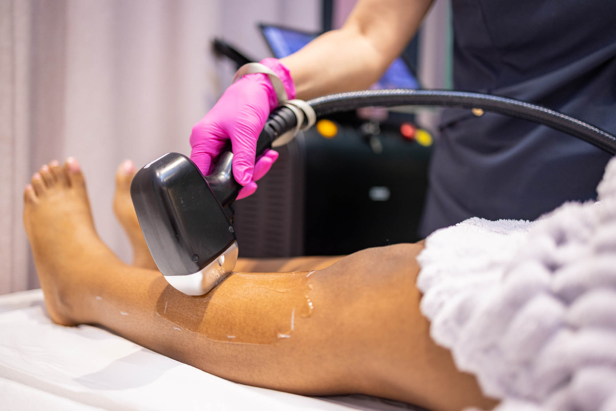 Laser Hair Removal